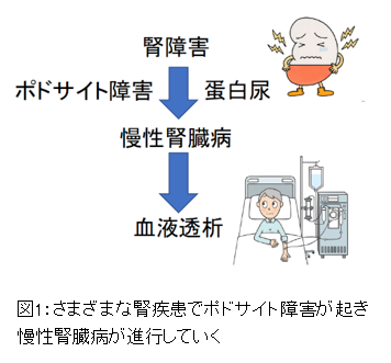 腎臓病進行を抑制する方法を発見 糸球体に現れるデンドリンの核移行