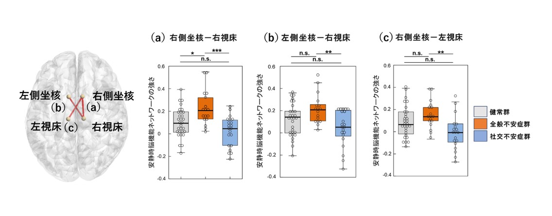 全般不安症と社交不安症を区別する脳内ネットワークを新たに発見